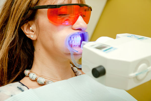 بلیچینگ آفیس دندان